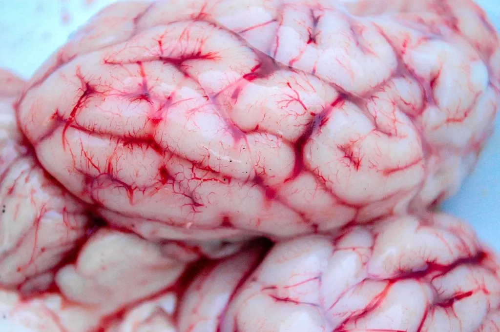 Hypoxic-Ischemic Encephalopathy Pathology