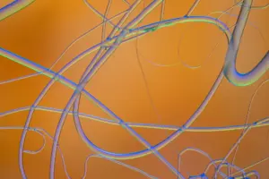 primary age-related tauopathy