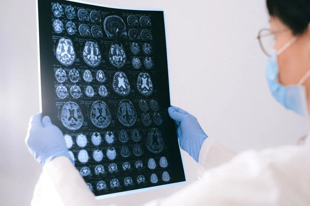 Neurodegenerative Diseases Pathology