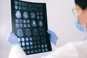 types of neurodegenerative diseases